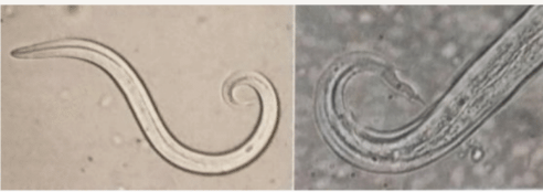 <p>What worm is this and what is diagnostic method?</p>