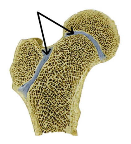 epiphyseal plate
