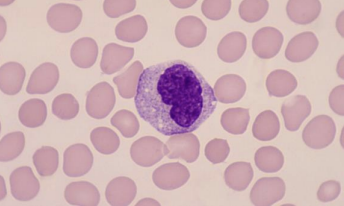 <p>what blood cells are these?</p>