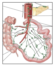 <p>One of a chain of lymph nodes in the mesentery,</p><p>the membrane that holds the gut in place. These</p><p>lymph nodes connect by lymphatics to the</p><p>lymphoid tissues of the gut, and pathogen-</p><p>bearing dendritic cells are transported there to</p><p>initiate additional adaptive immune responses</p><p>against gut pathogens.</p>
