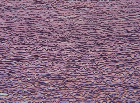 <p>-cellular component of <strong>fibroblasts</strong> (collagenous & elastic fibers)</p><p>-<strong>dark & squiggly lines</strong></p><p>-<strong>function</strong> → provide <strong>tissues with stretch & recoil,</strong> allowing them to <strong>expand & snap back to og shape</strong></p>