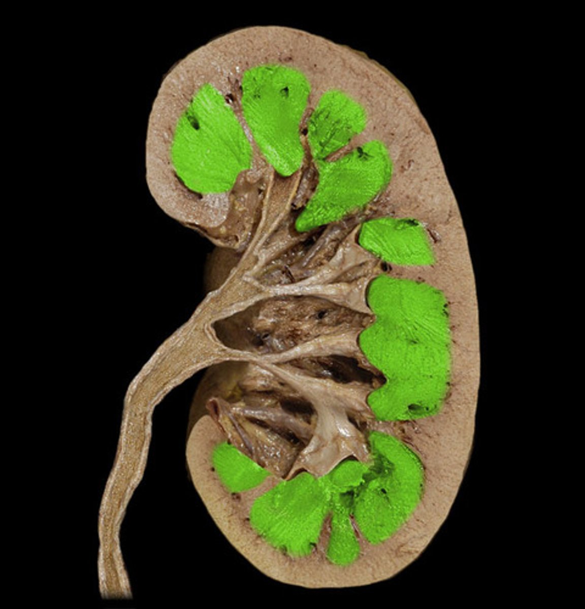 <p>• Cone-shaped renal pyramids</p>