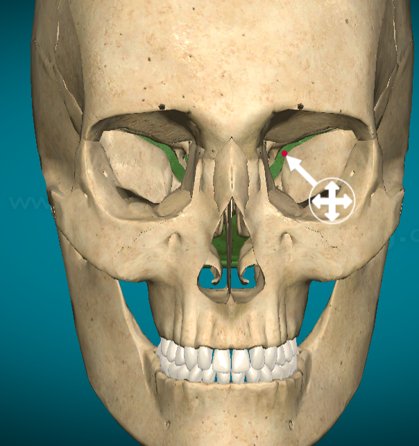 <p>Superior orbital fissure</p>