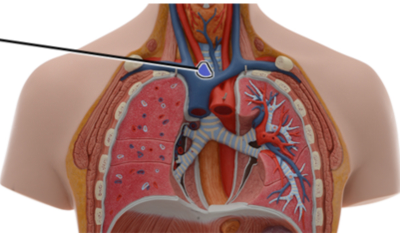 <p><span style="color: rgb(0, 0, 0);">Name this structure of the heart.</span></p>