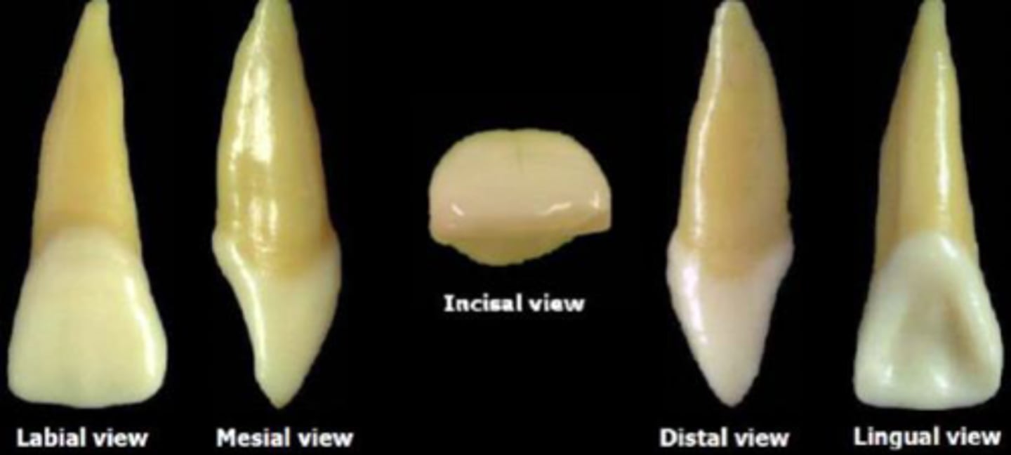 <p>what tooth is this?</p>