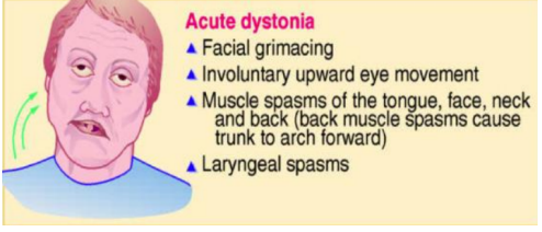 <p>Acute dystonia</p>