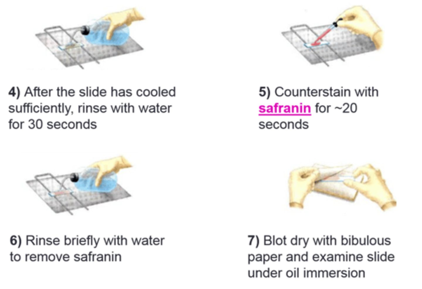 <p>Primary dye for this procedure:</p>