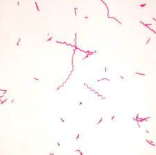 <p>What bacteria is this?</p>