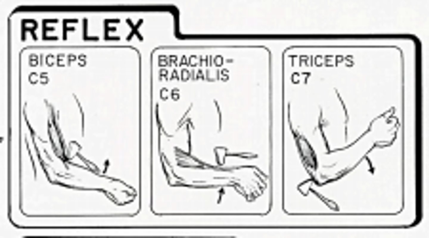 <p>C5 + C6 + RADIAL NERVE</p>