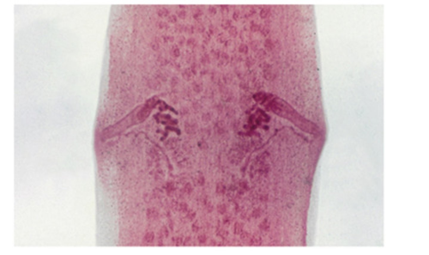 <p>The parasite with the common name cucumber seed tapeworm also holds a second common name associated with the appearance of the proglottids. That second common name is ___ tapeworm</p>
