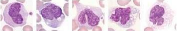 <p>What lymphocyte?</p>