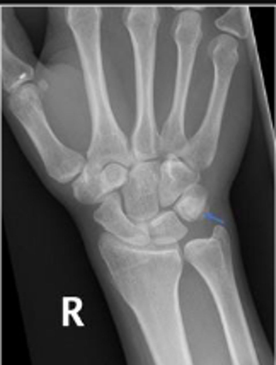 <p>What are the arrows pointing to?</p>