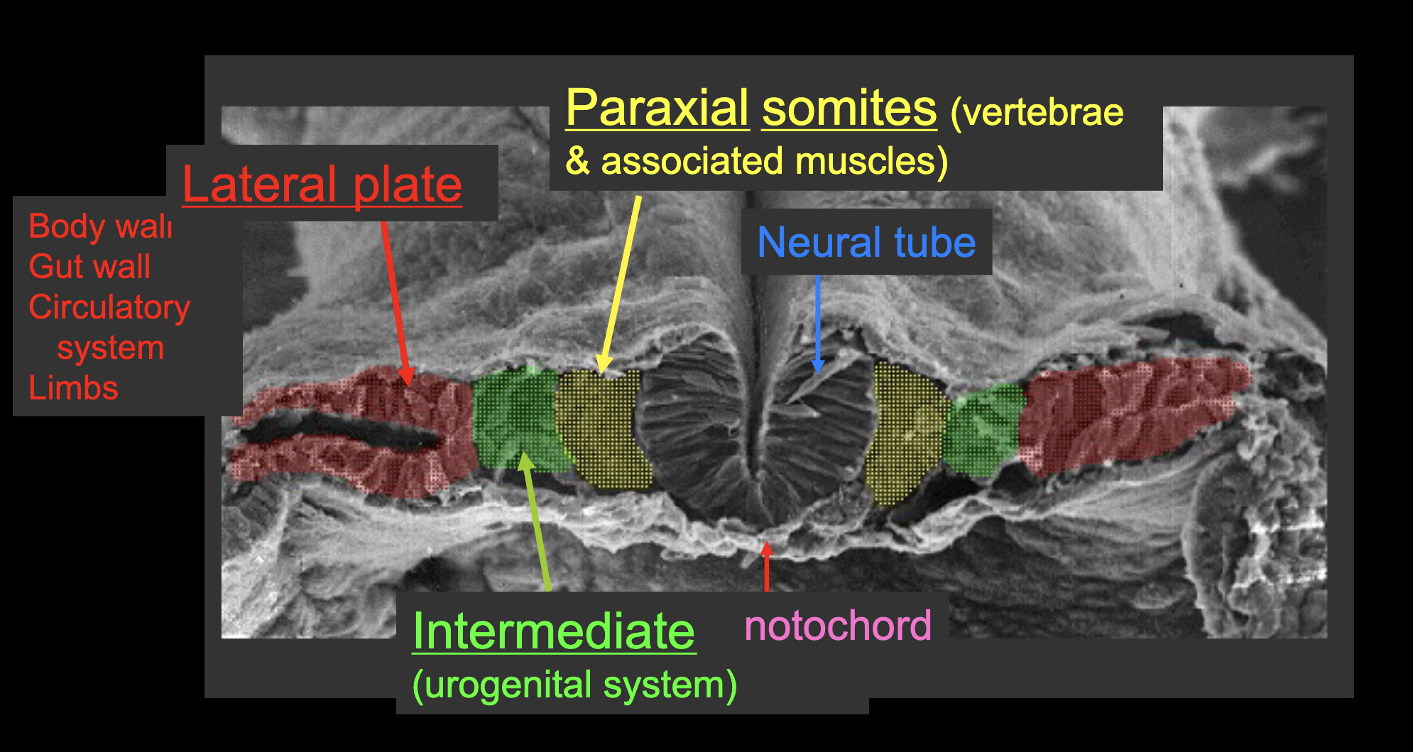 <p>Paraxial - somites - vertebrae &amp; muscles</p><p>Intermediate - urogenital, kidneys, gonads</p><p>Lateral plate - body walls, gut wall, circulatory, limbs</p>