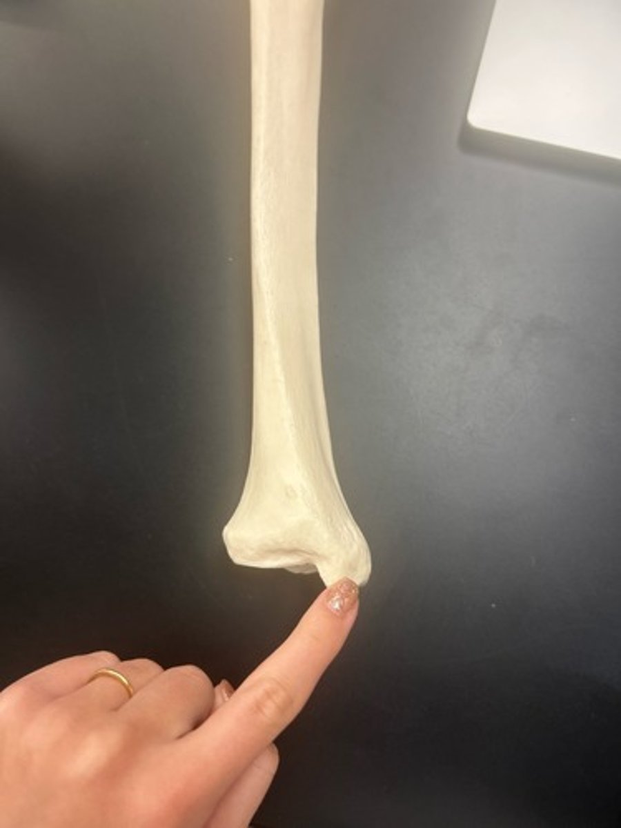<p>name the bone</p>