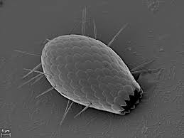 <p>Amoeboid with filopodia</p>