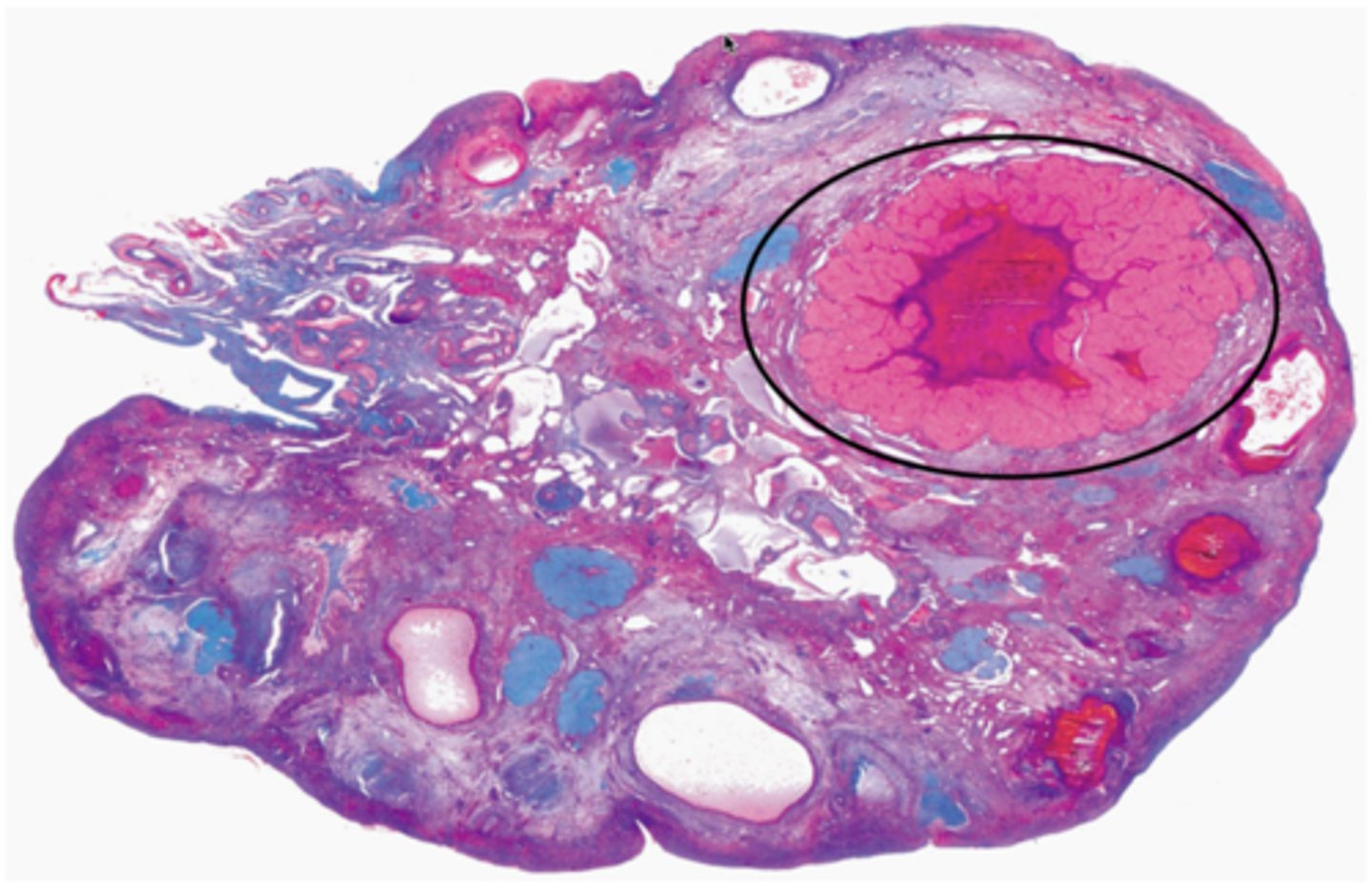 <p>This follicle will continue to grow into a mature/Graafian follicle, then ovulation will occur with the stimulation of an LH surge. After ovulation, the labeled structure appears in the ovary. What is the name of the labeled structure?</p>