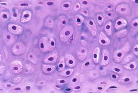 <p>Common, stiff-flexible cartilage; reduces joint friction.</p>