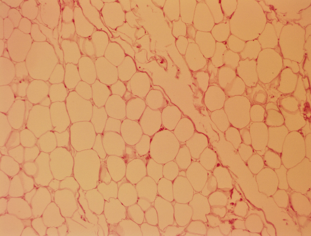 <p>A specialized connective tissue that stores fat, providing insulation and cushioning for organs, as well as energy storage. </p>