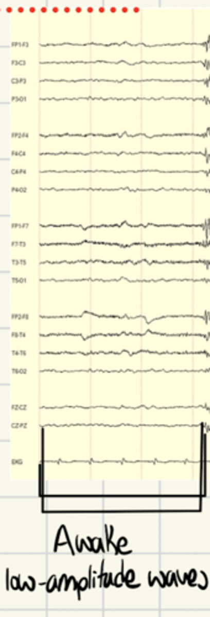<p>During awake phase neuron is in transmission mode</p><p>Signals transmitted as single spikes</p><p>Small, desynchronized, low voltage waves</p>