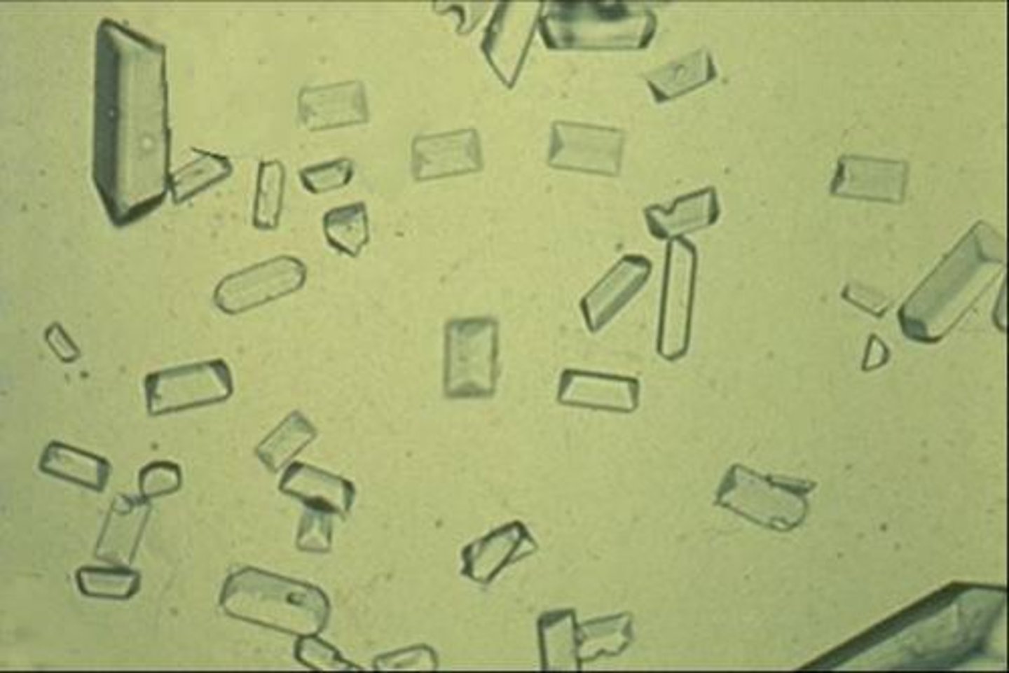 <p>-prism shape "coffin lid"<br>-Highly alkaline urine and urinary tract infections (UTIs)<br>-colorless</p>