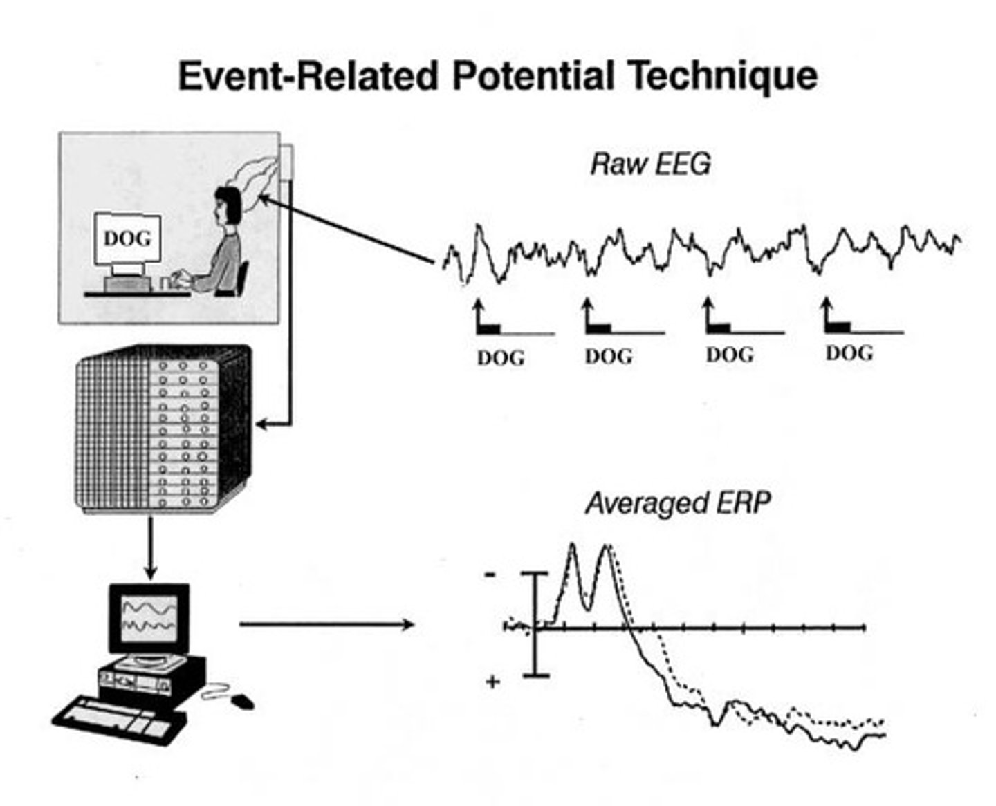 <p>Brain response measured during attention tasks.</p>