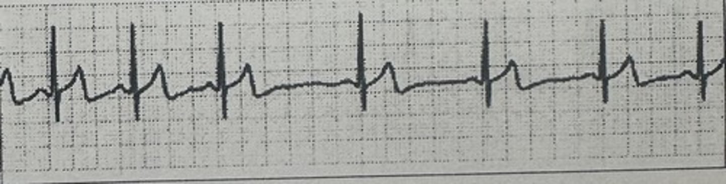 <p>identify the rhythm</p>