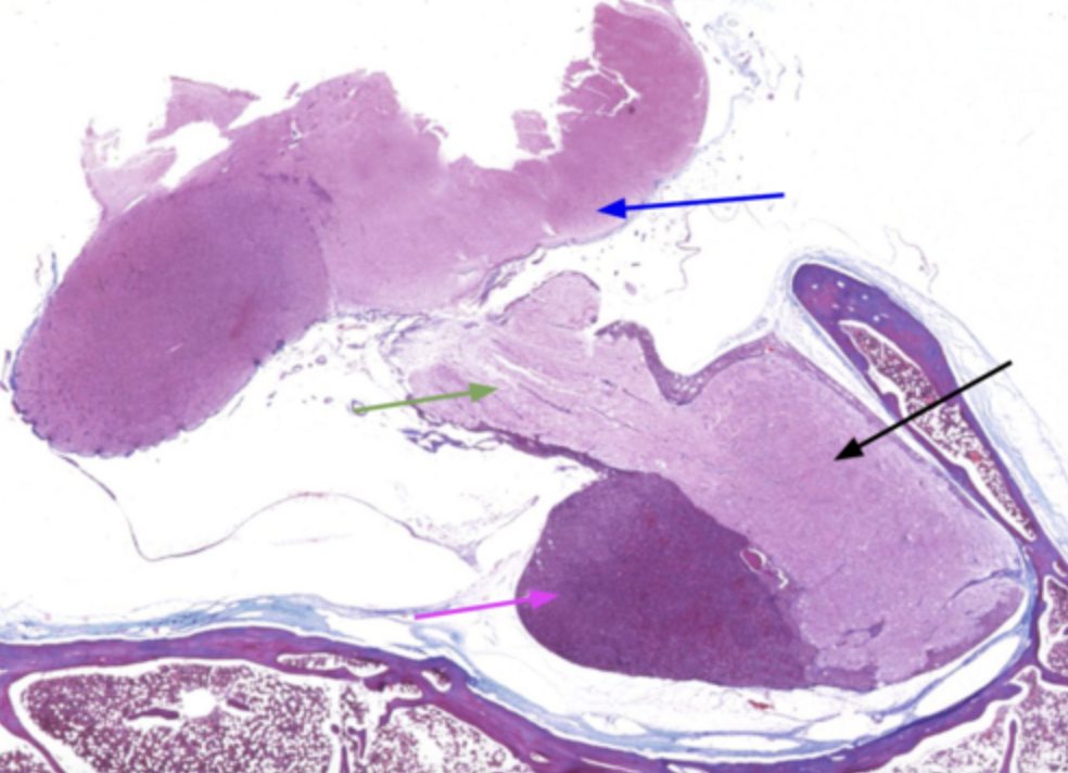 <p>What is the blue arrow?</p>