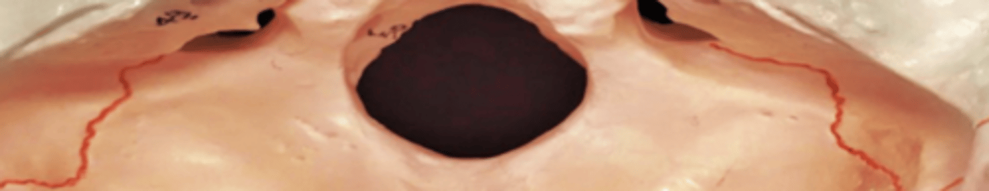 <p>posterior cranial fossa</p>