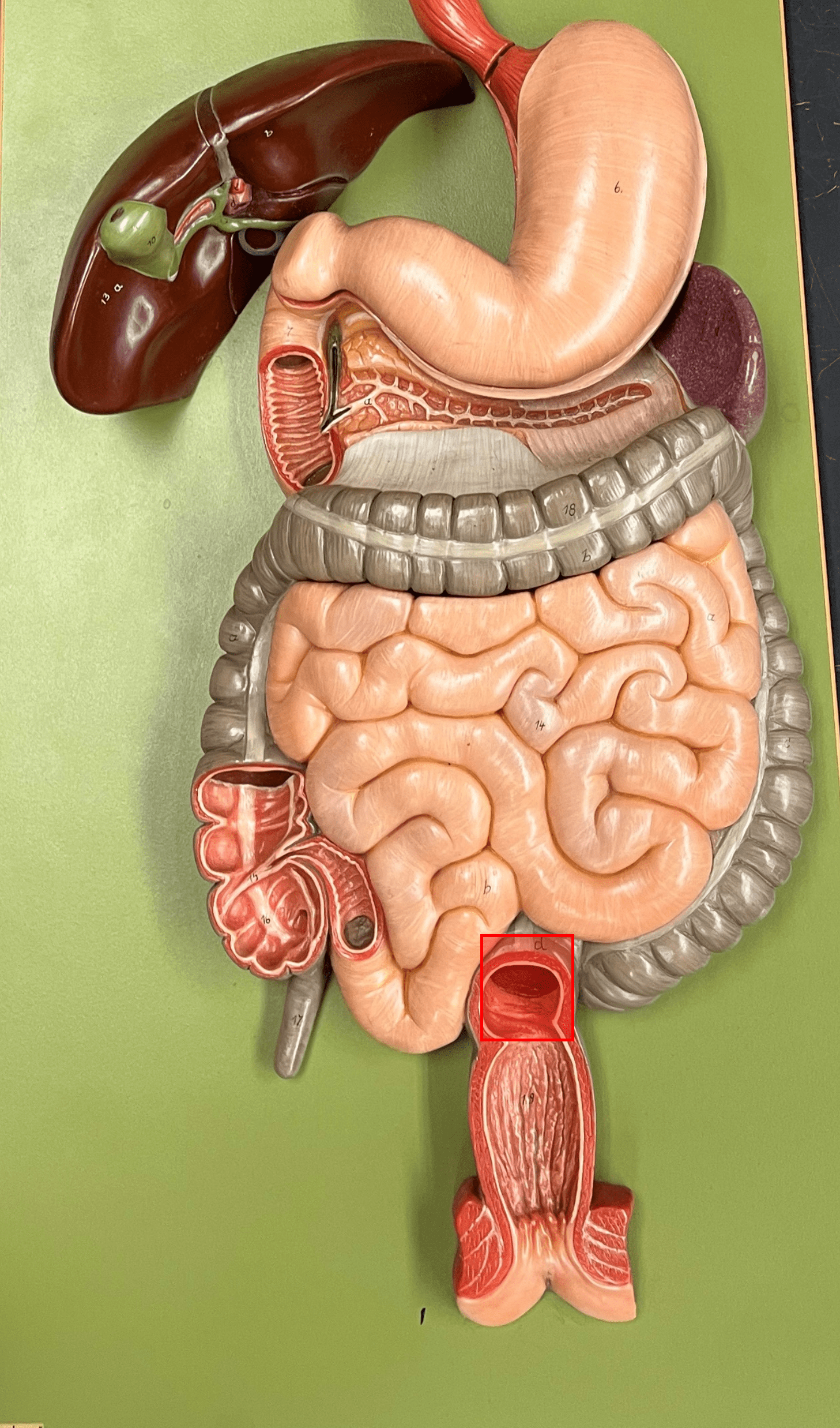 • A region of the large intestine.

• An area for holding feces until defecation.