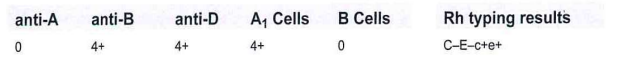 <p>231-The blood typing results shown in this table are noted on a patient's sample:<br><br>Whatis the patient's likely ethnicity?</p>