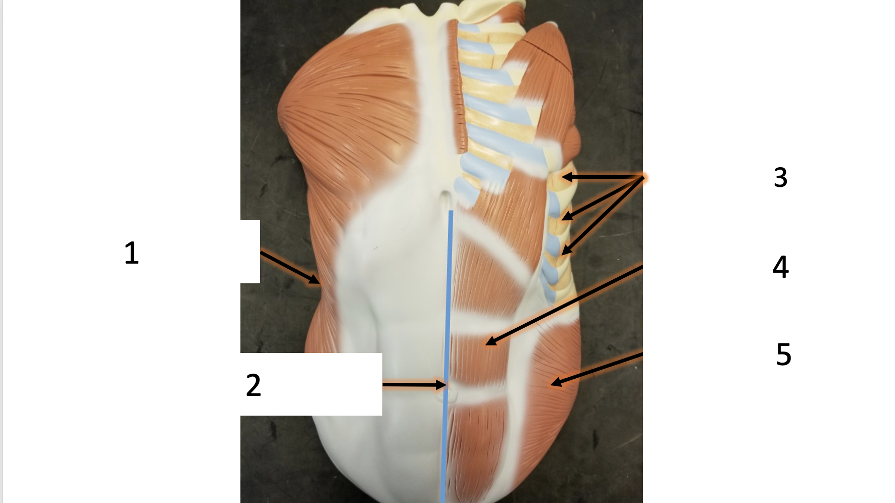 <p>name the muscle (1)</p>