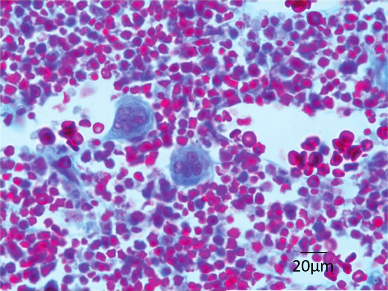 <p>16. Organs that serve immune defense are classified into primary and secondary lymphatic organs.</p><p>From which lymphatic organ was the histological specimen shown in the image obtained?</p><p>A. Bone marrow</p><p>B. Lymph node</p><p>C. Spleen</p><p>D. Thymus</p><p>E. Palatine tonsil (Tonsilla palatina)</p>