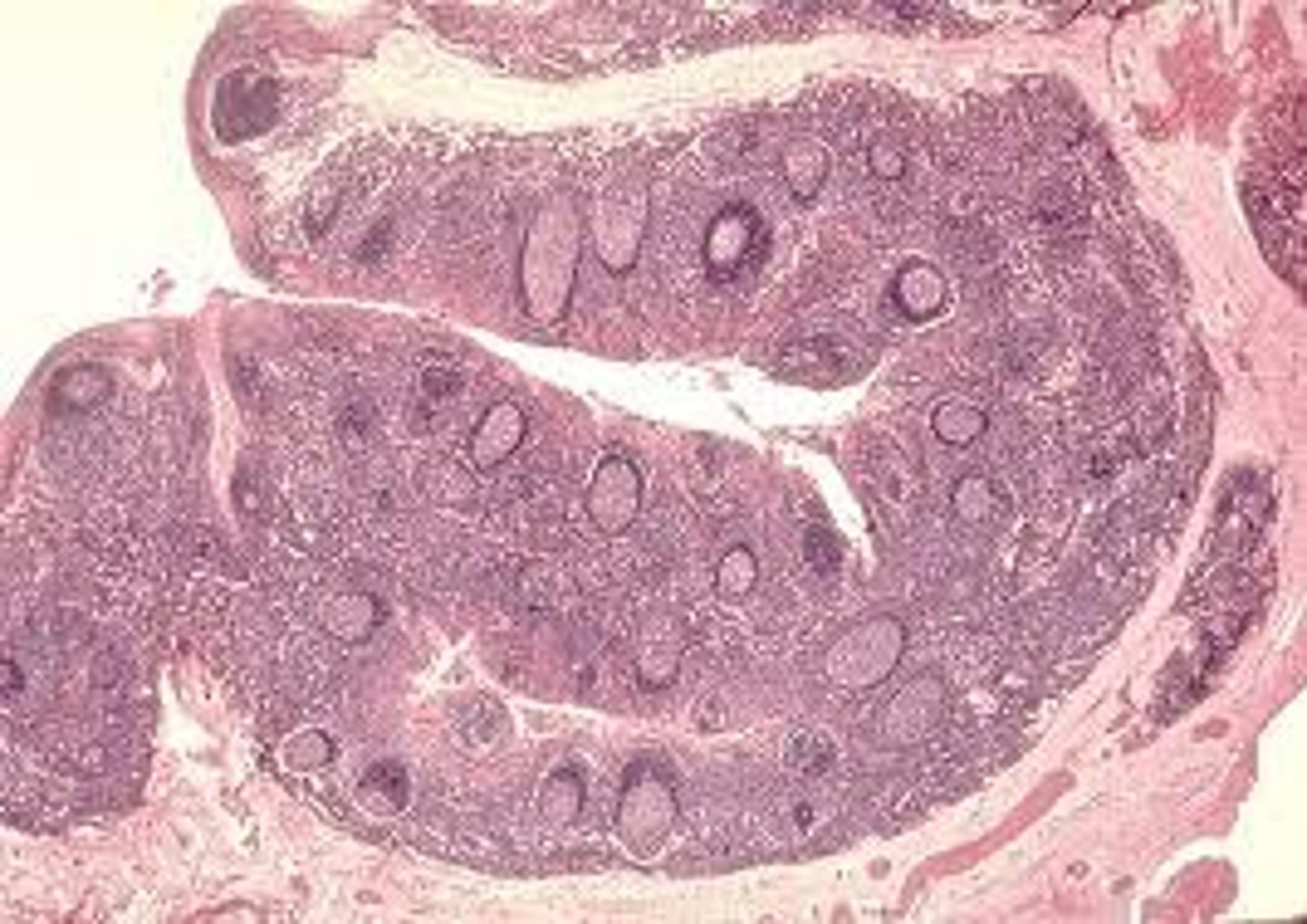 <p>Function - Protection, Secretion.</p><p>Location - Rare in the body, small amounts in male urethra and large ducts of some glands.</p>