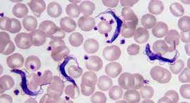 <p><strong>Mention two direct methods for detection of this parasite.</strong></p><div data-type="horizontalRule"><hr></div><p><strong>How to differentiate between the two species of this parasite? And which antibody can be elevated?</strong></p><div data-type="horizontalRule"><hr></div><p><strong>Which parasite species has available card agglutination test?</strong></p><div data-type="horizontalRule"><hr></div><p><strong>Mention two characteristics of CSF in this disease.</strong></p>