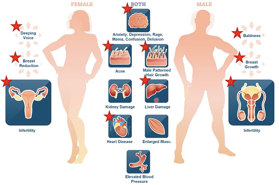 <ul><li><p>female: deepening of voice, breast reduction, infertility</p></li><li><p>male: baldness, breast growth, infertility</p></li><li><p>both: </p><ul><li><p>psychological effects (anxiety, depression, rage, mania, confusion, delusion)</p></li><li><p> acne</p></li><li><p>male-patterned hair growth,</p></li><li><p>liver dmg (jaundice and liver cancer)</p></li><li><p>heart disease (decreased HDL / increased LDL)</p></li></ul></li></ul><p></p>
