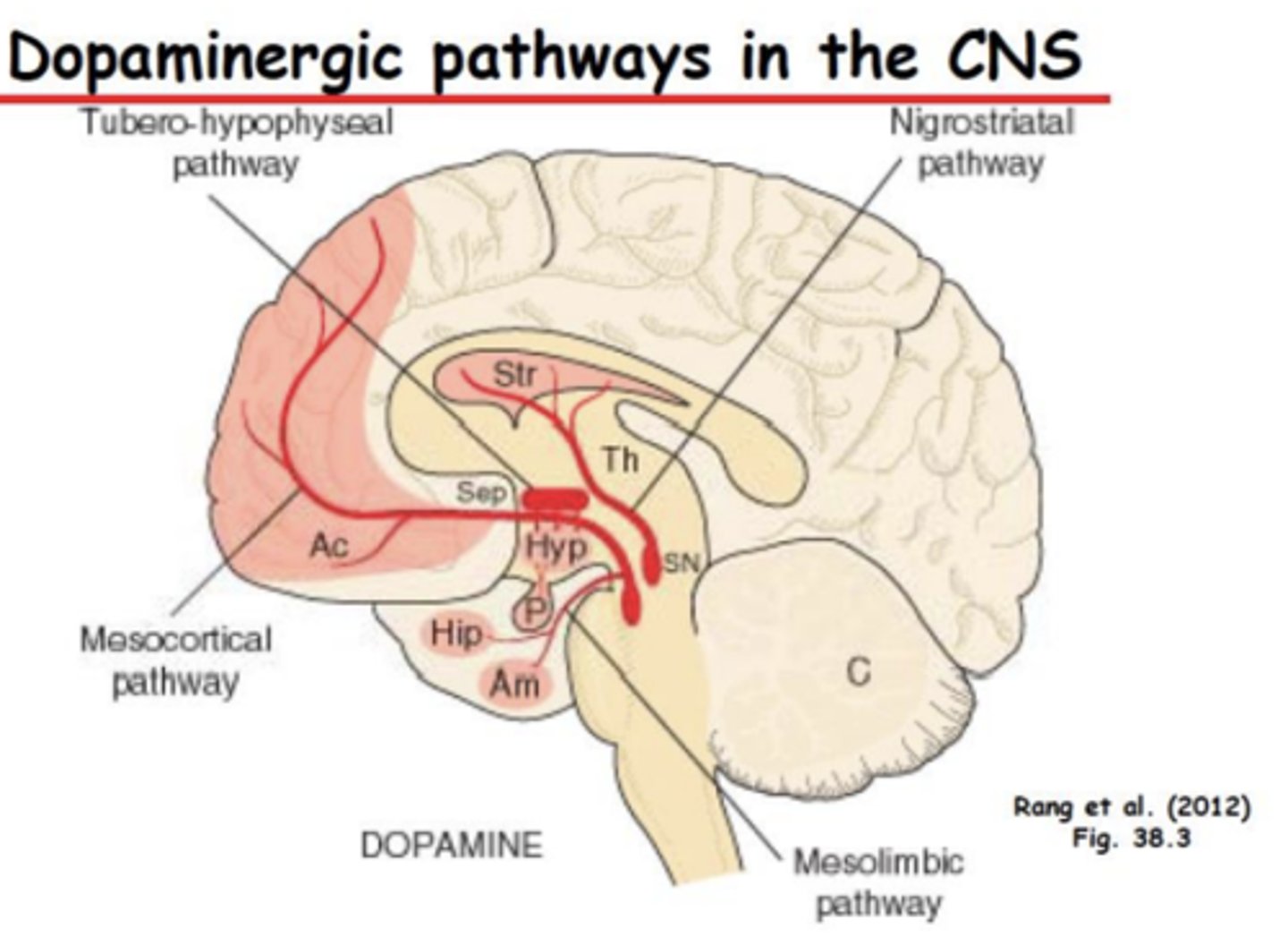 <p>– Decrease in DA signaling causes negative symptoms </p><p>– Negative symptoms include decreased motivation, emotion, and pleasure. Attentional deficits</p>