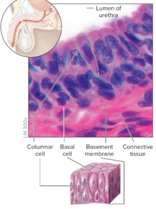 Nonciliatred Pseu. Columnar Epithelium.