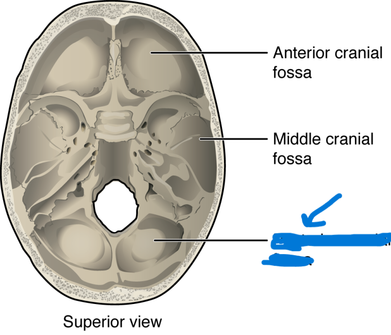 <p>What is this feature of the skull?</p>