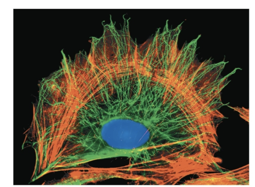 <p>Cytoskeleton</p>