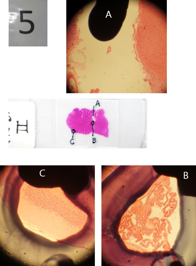 **Post 5.**

__Præparat II: Histologisk snit af del af CNS (Cerebellum med hjernestamme)__

\
**Spørgsmål 7:** Hvilken særlig væsentlig nervecelletype findes i strukturen C?