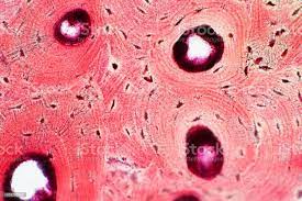 <p>Matrix of collagen and calcium salts with osteocytes found in lacunae ( central canal and canaliculi)</p>