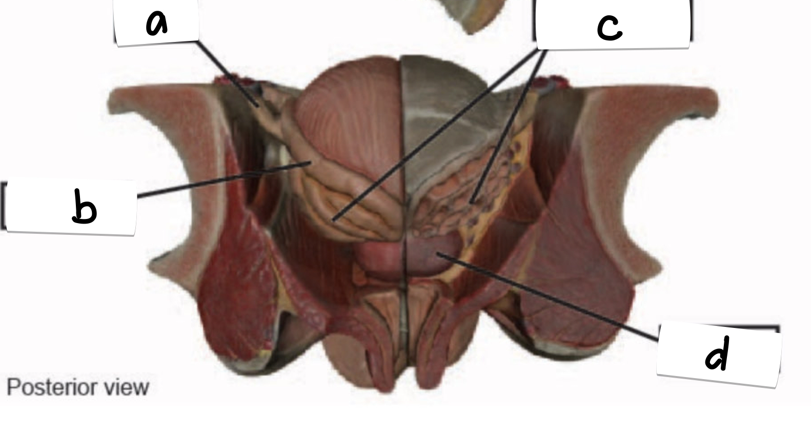 <p>what is labeled a on the male reproductive model</p>