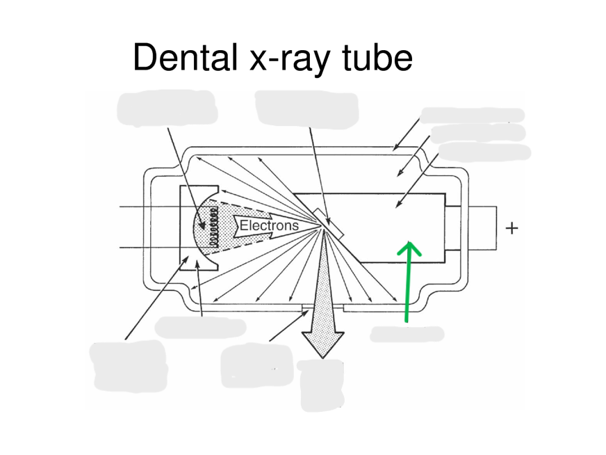 <p>the<strong> positively charged electrode </strong>in the X-ray tube, where the emitted electrons collide to produce X-rays. (+)</p>
