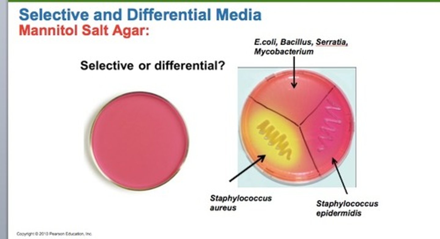 <p>one to which some sort of an indicator, usually a dye or ph indicator, has been added, which allows you to differentiate between various chemical reactions carried out during growth.</p>