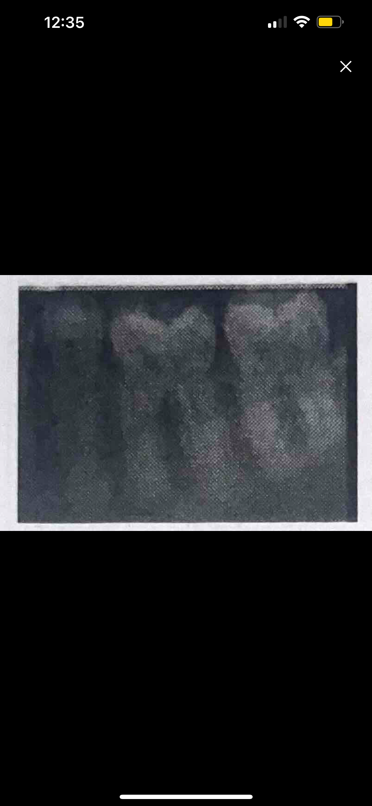 <p>Identify the major placement error in this periapical molar image.</p>