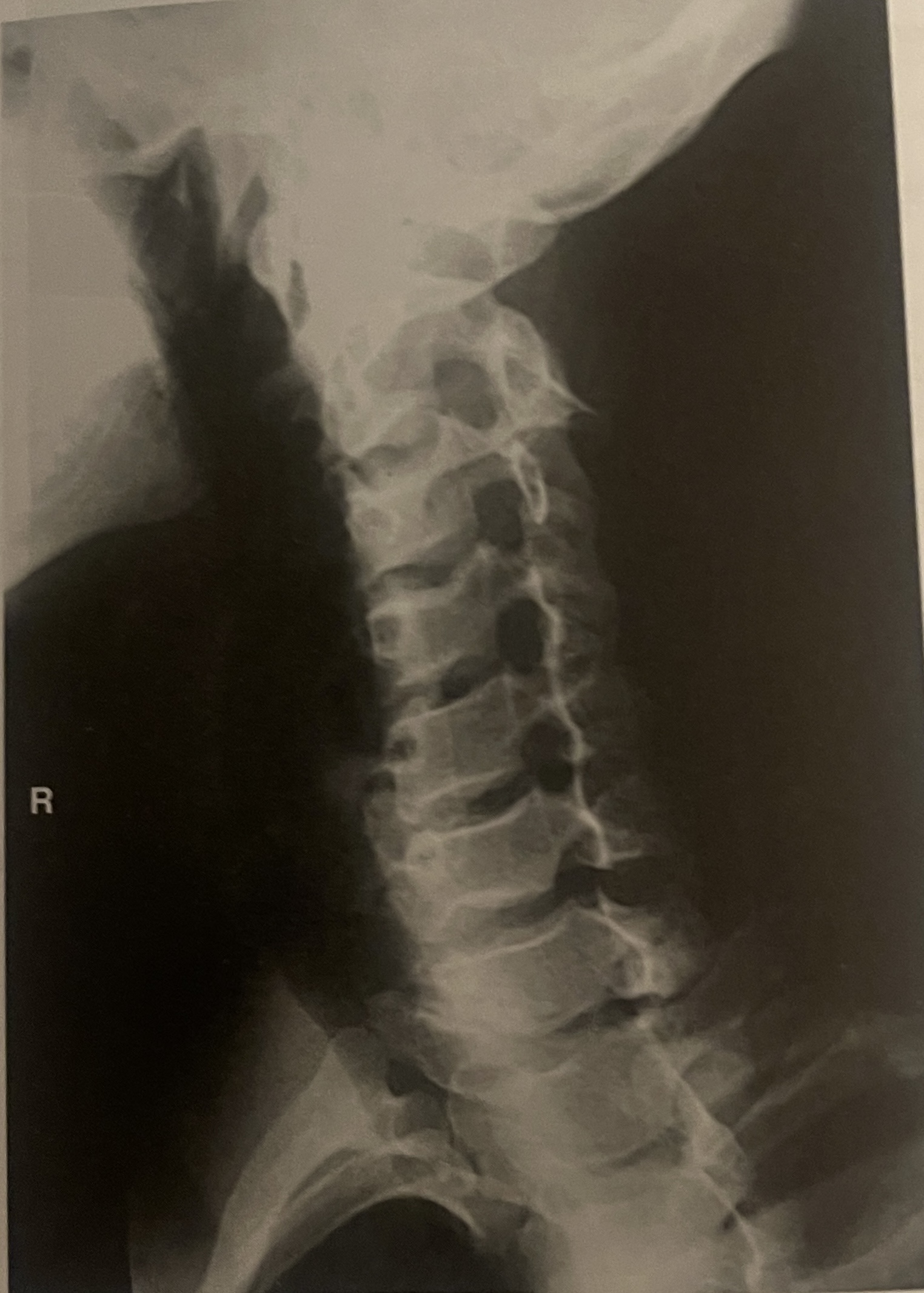 <p>Is the anatomy demonstrated closer or or farther from the IR?</p>