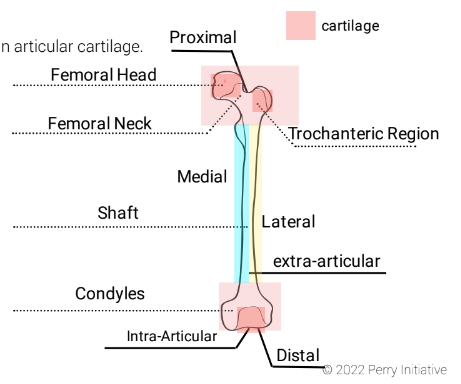 Location: Within a joint; affecting the joint's interior.