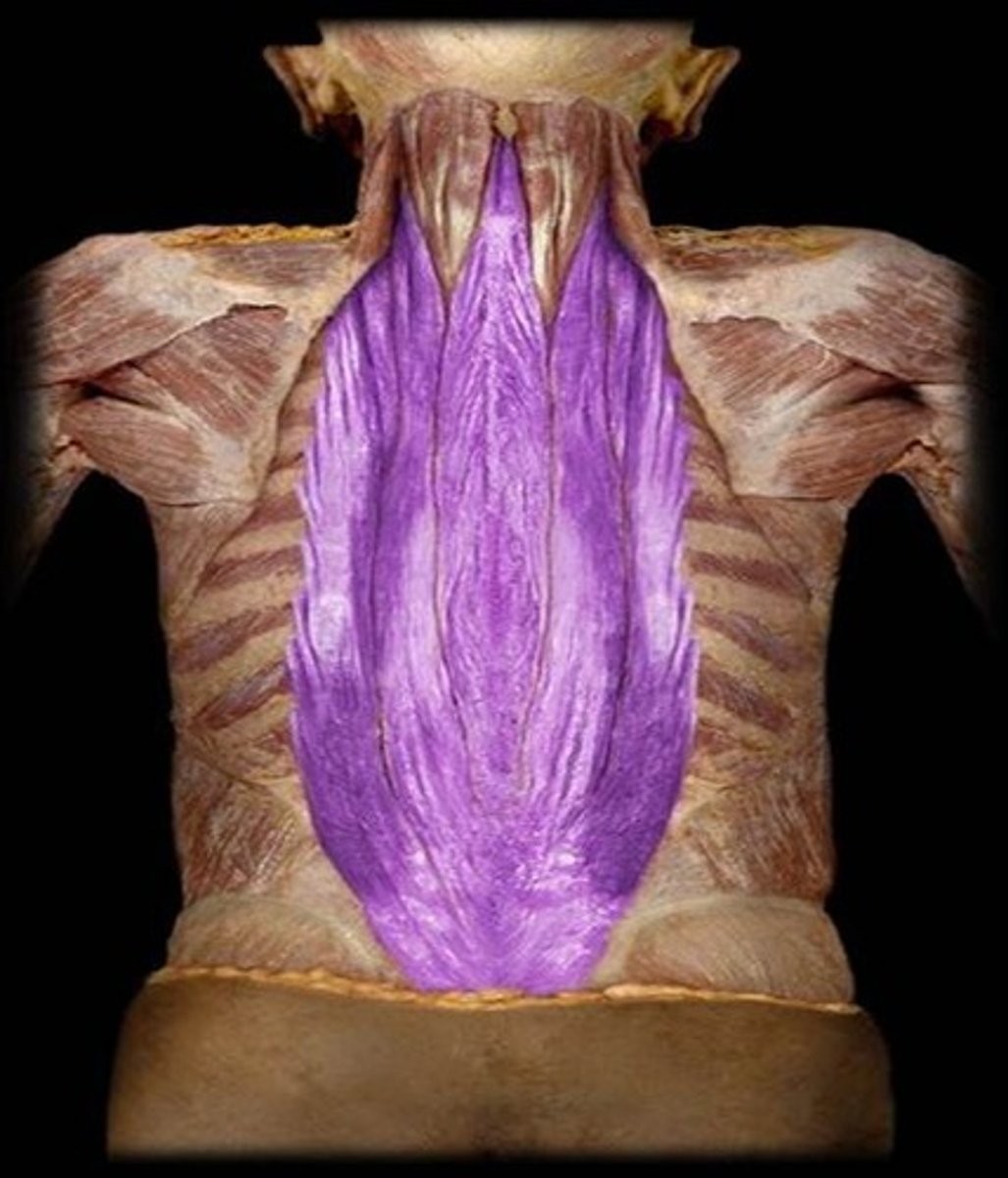 <p>What is the name of this muscle, highlighted in purple?</p>