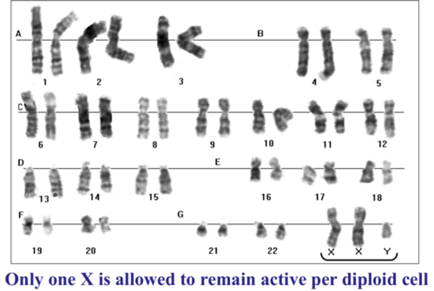 <p>- males have an extra X chromosome, causing feminine body shape<br>- aneuploidy due to nondisjunction</p>
