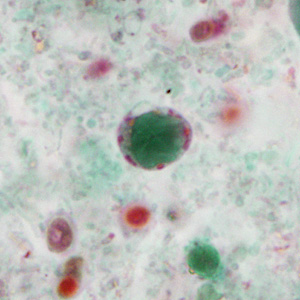 <p>Trichrome stain</p>